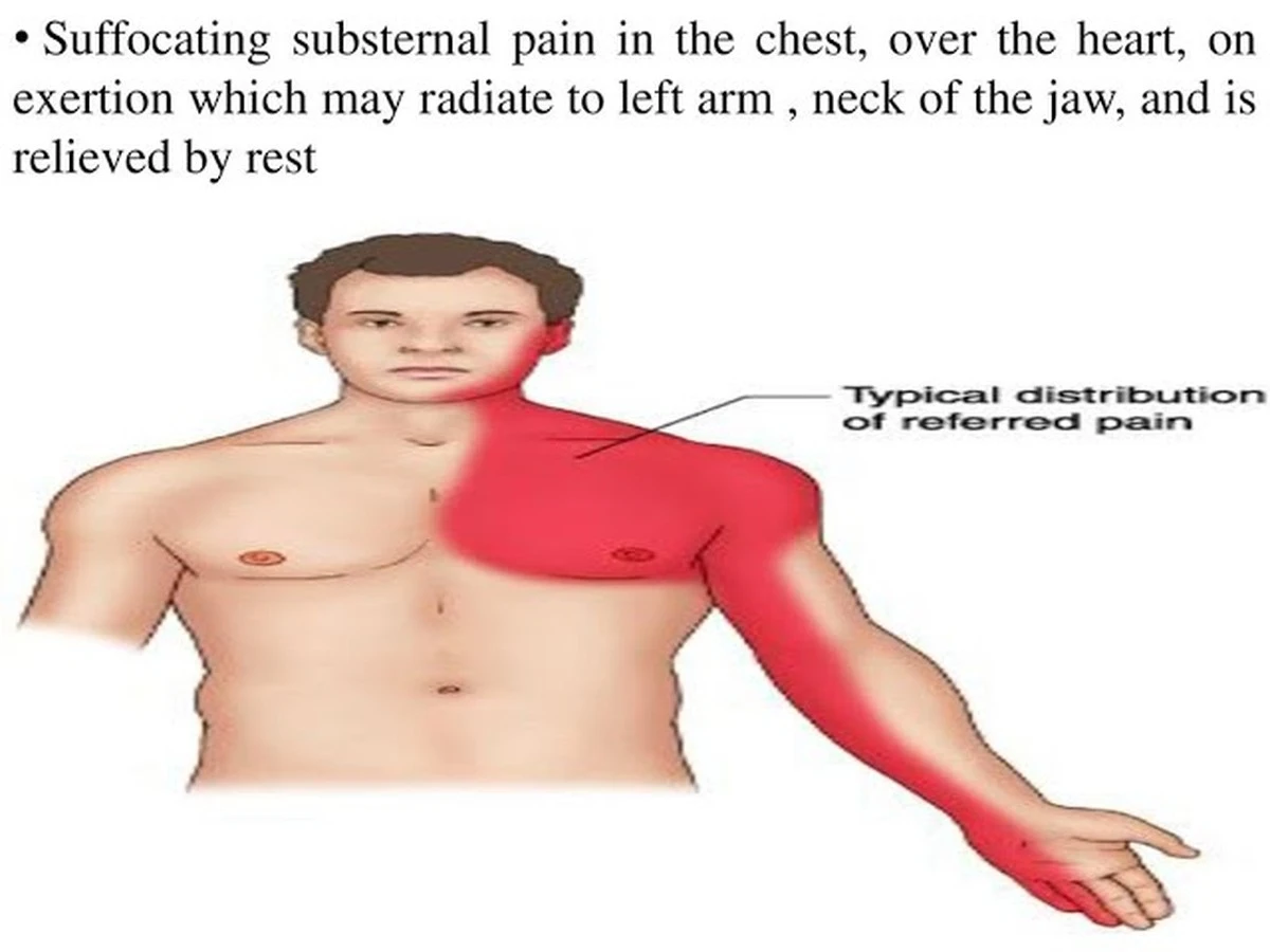 Ból w lewym barku: 5 sygnałów, których Polacy nie mogą ignorować w 2026 roku - image 1